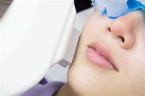Laser Skin Treatments Contraindications And After Care