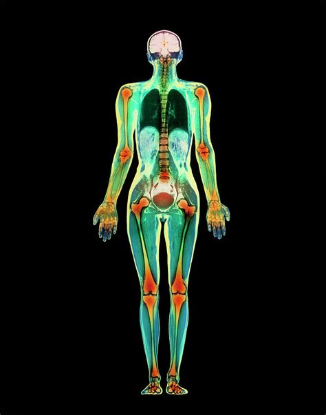 Coloured Mri Scan Of A Whole Human Body Female 2 Photograph By Simon