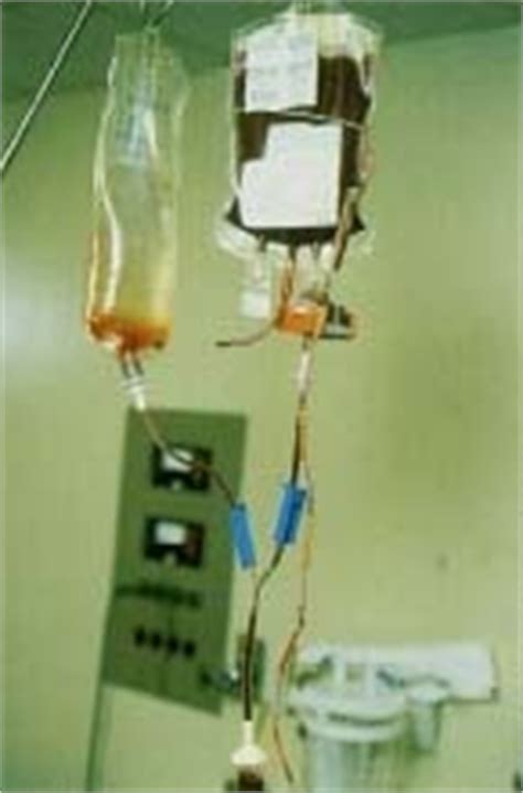 Leopold grew up to be a tall. Hemophilia - body, contagious, causes, What Is Hemophilia?