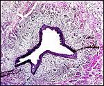 Small Amount Of Blood From Umbilical Cord Images