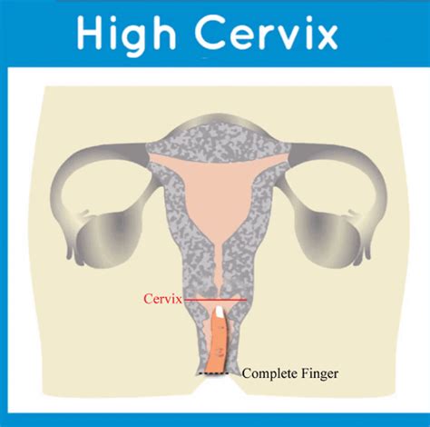 Best Menstrual Cups For Low High Cervix How To Measure It