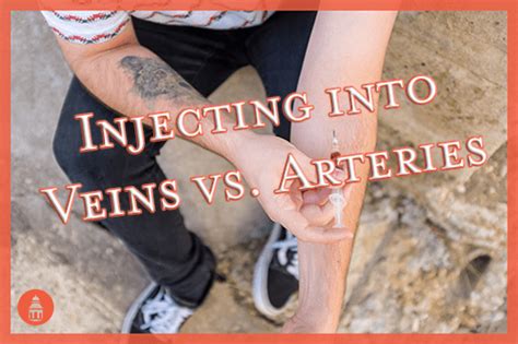 Injecting Drugs Into Veins Vs Arteries San Diego Addiction Treatment