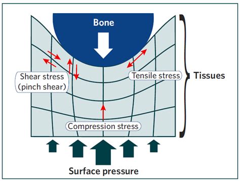 Shear stress, force tending to cause deformation of a material by slippage along a plane or planes parallel to the imposed stress. What is Shear Force?