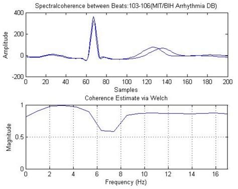 Spectral Coherence Between Normal Normal Beats In The Figure 9 3d