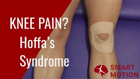 ANTERIOR KNEE PAIN Use This TAPE What To Do If You Have Hoffa S Fat