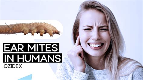 Mite Bites On Humans Face