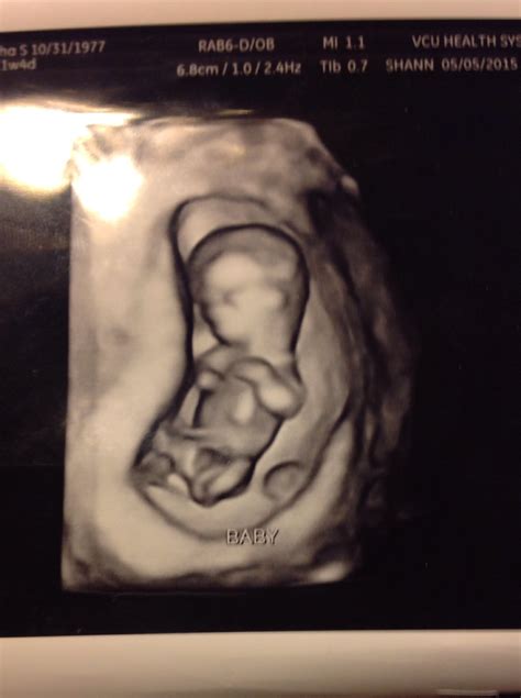 3d Ultrasound At 16 Weeks — The Bump
