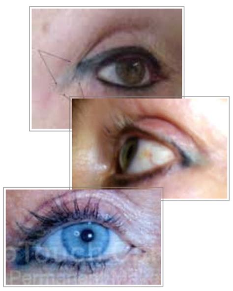 The Risks Of Having Permanent Eyeliner Treatments Katy Jobbins