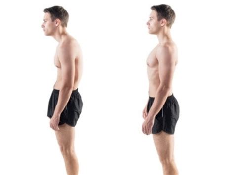 How To Fix Rounded Shoulders Posture Shreddedcore