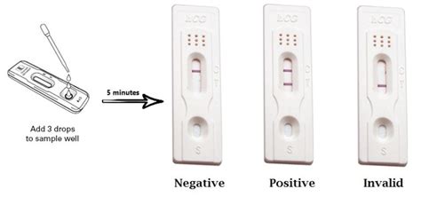 Urine Pregnancy Test Upt Principle Procedure Interpretation And Limitations