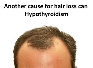 Because the natural hair growth cycle takes several months, hair loss related to thyroid disease might only be seen months after the illness has begun. Oh my God! I am losing too much hair - Endhairloss.eu