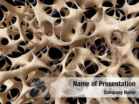 Osteoporosis Powerpoint Template Osteoporosis Powerpoint Background