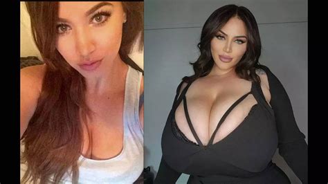 Rare Condition Causes OnlyFans Model S Breasts To Grow 6 Cup Sizes In