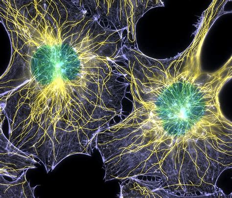 Actin Purple Microtubules Yellow And Nuclei Green Are Labeled