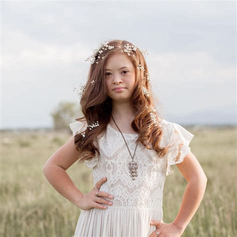 Model With Down Syndrome Breaks Barriers With High Profile Campaigns