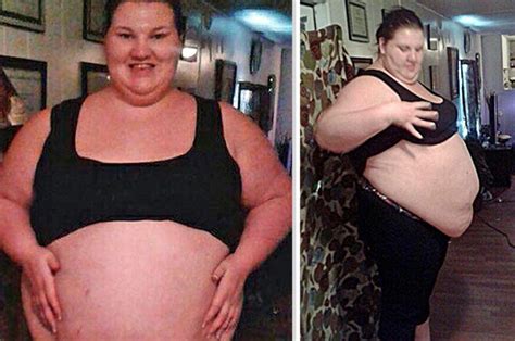 obese woman who gorged on 11 000 a day loses 17st after having gastric bypass surgery daily star