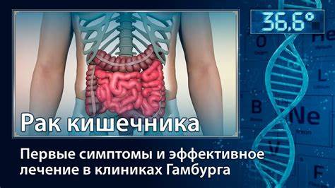 Лечение кишечника диета Рак кишечника. Первые симптомы и эффективное лечение в клиниках Рак кишечника. Первые симптомы и эффективное лечение в клиниках Лечение кишечника диета