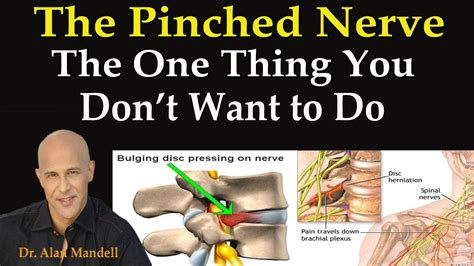 21 How To Release A Pinched Nerve In Shoulder And Neck 2022
