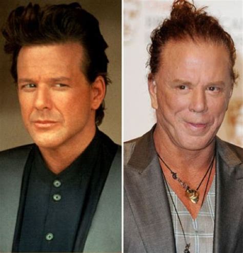 the evolution of mickey rourke before and after plastic surgery lips filler in 2019