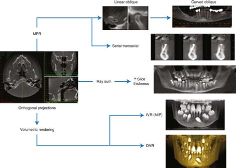 12 Cone Beam Computed Tomography Volume Preparation Pocket Dentistry