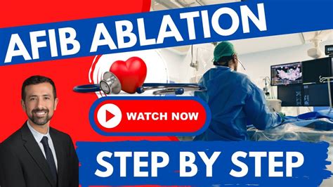 Afib Ablation Made Easy Expert Consultation Guide Youtube