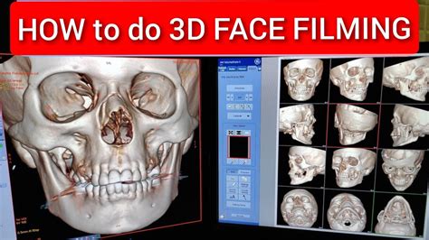 3d Ct Scan Of Face Pns Filming Protocol Youtube