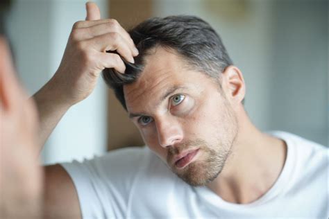 Hair Loss In Men Due To Hormonal Imbalance Healthgains