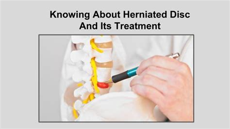Ppt Knowing About Herniated Disc And Its Treatment Powerpoint