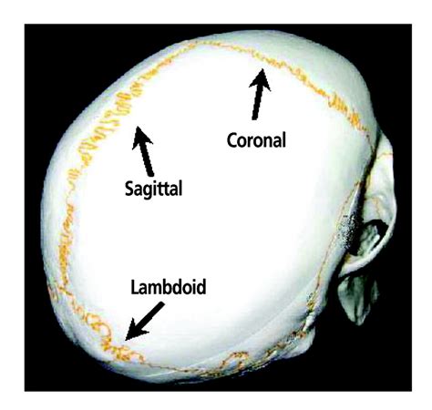 Significance Of Differences In Patency Among Cranial Sutures