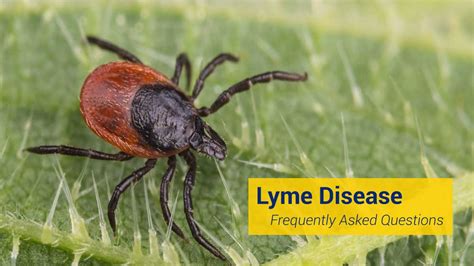 Frequently Asked Questions Faqs Johns Hopkins Medicine Lyme Disease