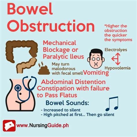 Bowel Obstruction Bowel Obstruction Nursing School Prerequisites Top Nursing Schools