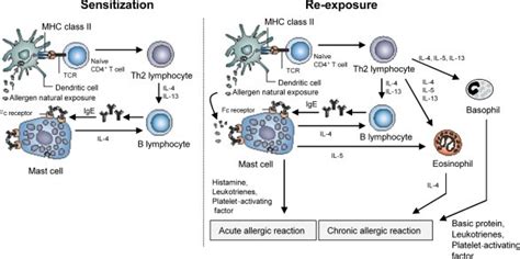 Schematic Representation Of The Pathophysiology Of Allergic Asthma In