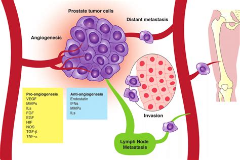 The Role Of Angiogenesis In Tumor Progression Post Natal Angiogenesis Download Scientific