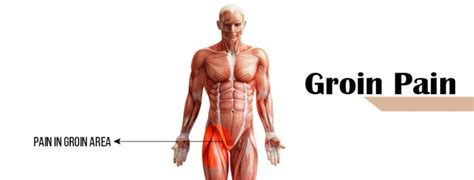 Groin Pain And Swollen Lymph Nodes In Men What Could It Mean