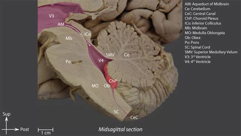 Fourth Ventricle Brain Anatomy