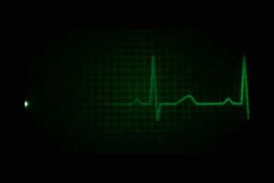 Heart Rate Flatline Gif