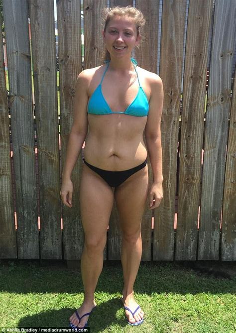 Virginia Woman Who Weighed Just Lbs Overcomes Anorexia Daily Mail