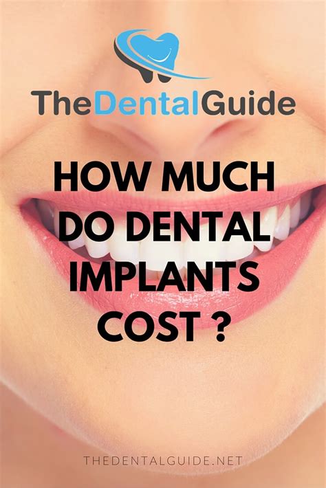 Dental Implants Costs And Information The Dental Guide