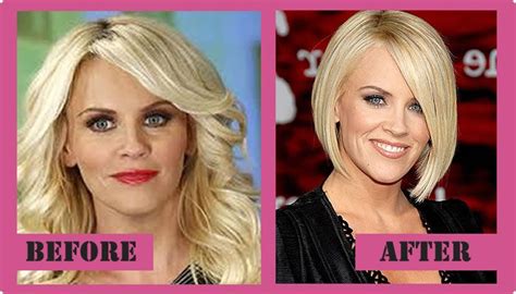Jenny Mccarthy Plastic Surgery Before And After Jenny