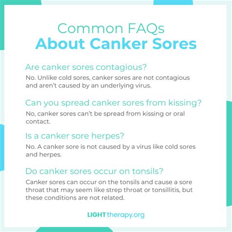 Canker Sore Faqs Light Therapy