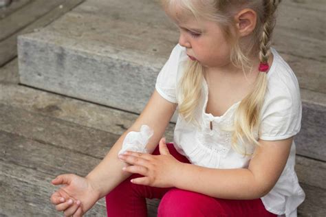 How To Treat Staph Infections In Kids Pediatric Associates Of Franklin