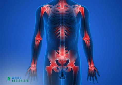 Joint Pain Symptoms Causes Effect And Treatment