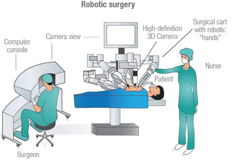Innovations Explained What Are Surgical Robots Giddyup