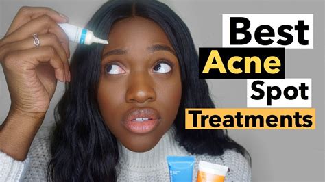Best Acne Spot Treatment How To Get Rid Of Acne Fast Youtube