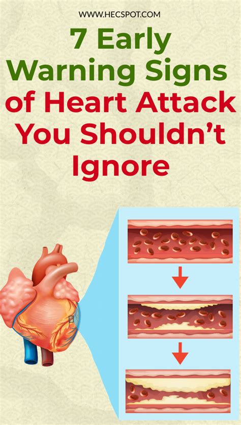 7 Early Warning Signs Of Heart Attack You Shouldnt Ignore Hecspot