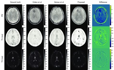 Exemplary Map Reconstructions Of One Axial Brain Slice The Rows