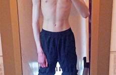 anorexia anorexic male battled death bake hotspot 4lbs weighed 7st
