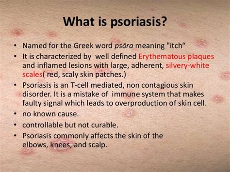 Psoriasis