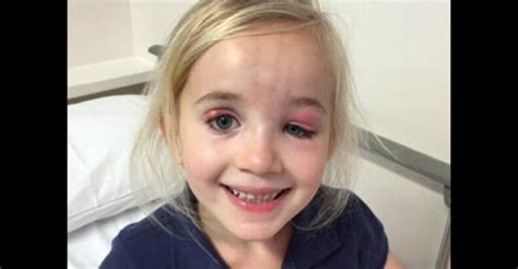 doctors kept telling her it was just an eye infection mom realizes they are very wrong relay hero