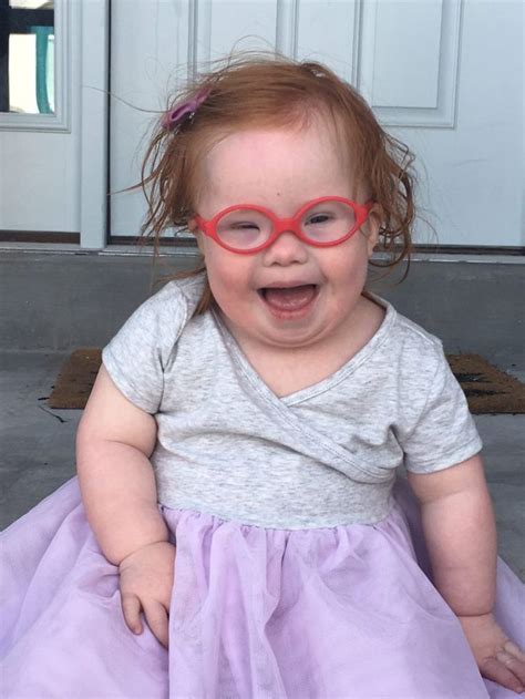 Labor And Delivery Nurse Gets A Down Syndrome Diagnosis Down Syndrome Diagnosis Down Syndrome
